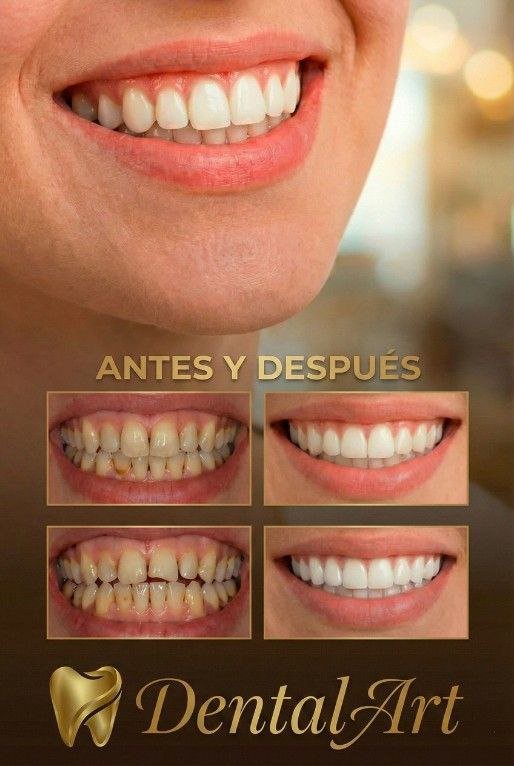 Diseño de Sonrisa DentalArt Móvil